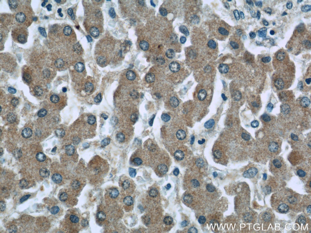 Immunohistochemistry (IHC) staining of human liver tissue using C3/C3b/C3c Monoclonal antibody (66157-1-Ig)