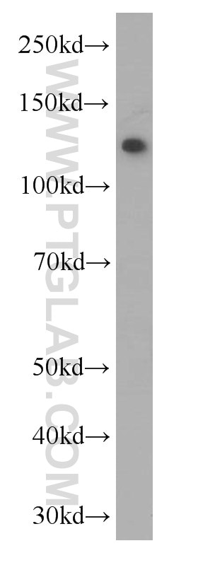 Western Blot (WB) analysis of human blood using C3/C3b/C3c Monoclonal antibody (66157-1-Ig)