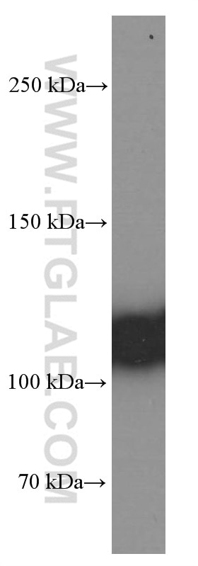 Western Blot (WB) analysis of human plasma using C3/C3b/C3c Monoclonal antibody (66157-1-Ig)