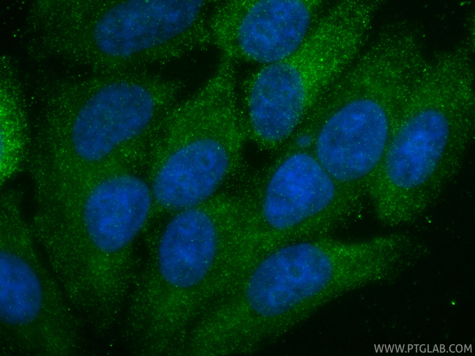 Immunofluorescence (IF) / fluorescent staining of HepG2 cells using C3 Recombinant monoclonal antibody (87386-1-RR)