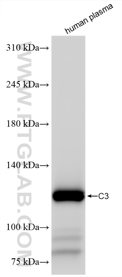 WB analysis of human plasma using 87386-1-RR Western Blot (WB) analysis of human plasma using C3 Recombinant monoclonal antibody (87386-1-RR)