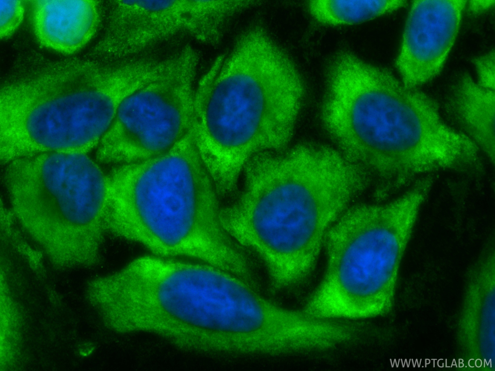 IF Staining of HepG2 using CL488-87386 Immunofluorescence (IF) / fluorescent staining of HepG2 cells using CoraLite® Plus 488-conjugated C3 Recombinant monoc (CL488-87386)