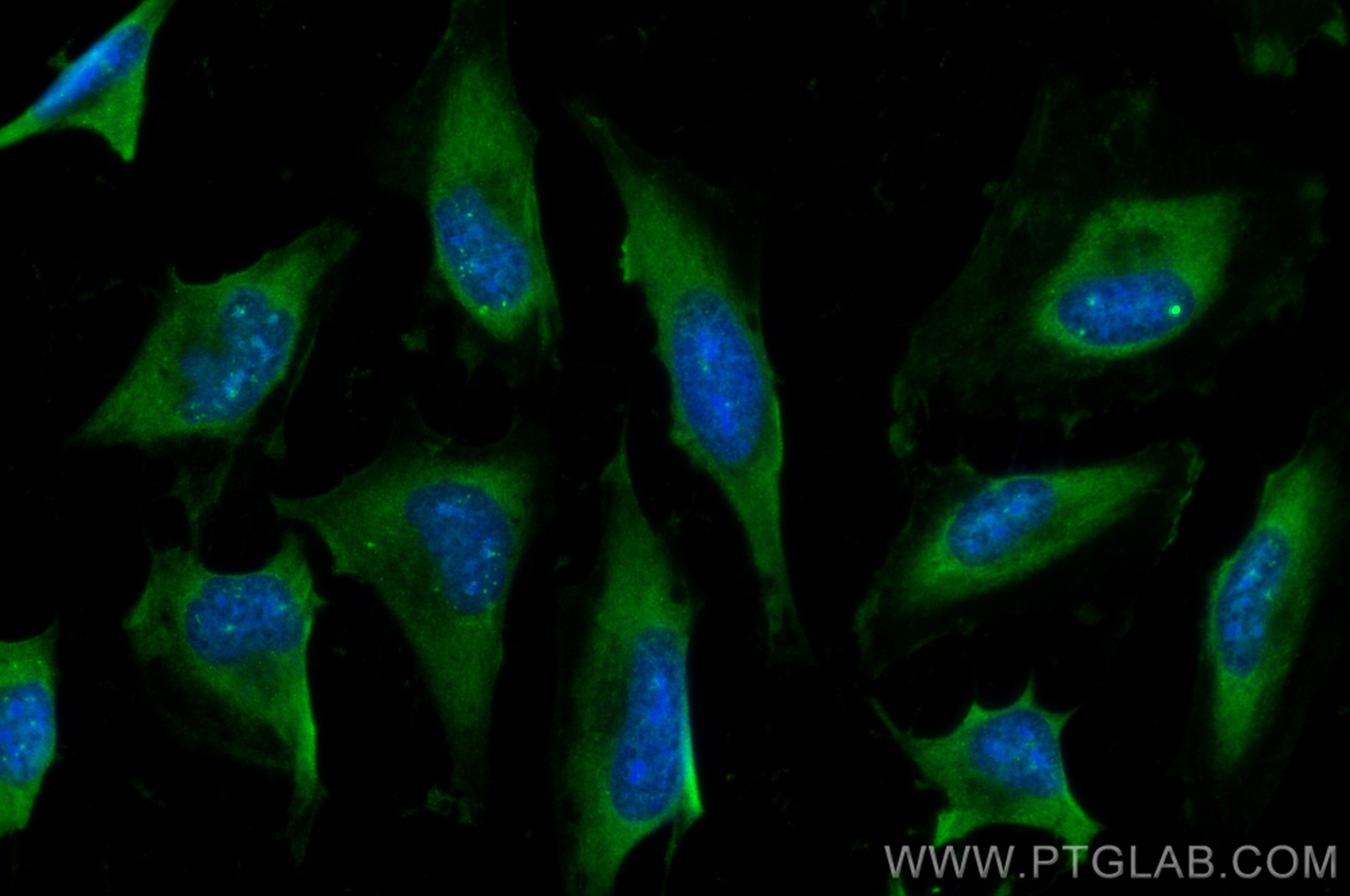 Immunofluorescence (IF) / fluorescent staining of HeLa cells using CoraLite® Plus 488-conjugated C3/C3b/C3c Polyclona (CL488-21337)
