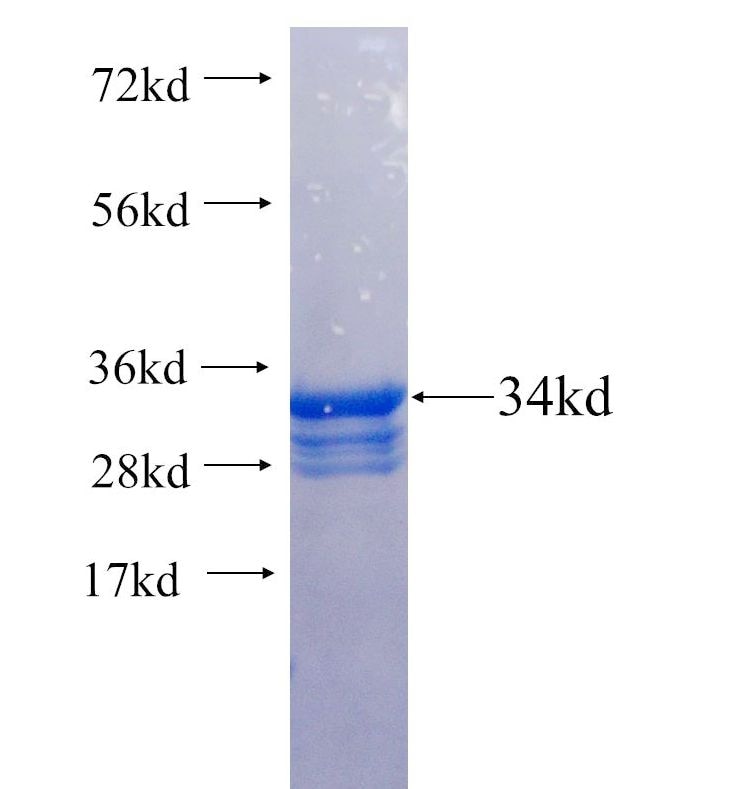 C3 fusion protein Ag25612 SDS-PAGE