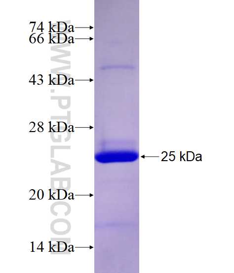 C3AR1 fusion protein Ag28257 SDS-PAGE