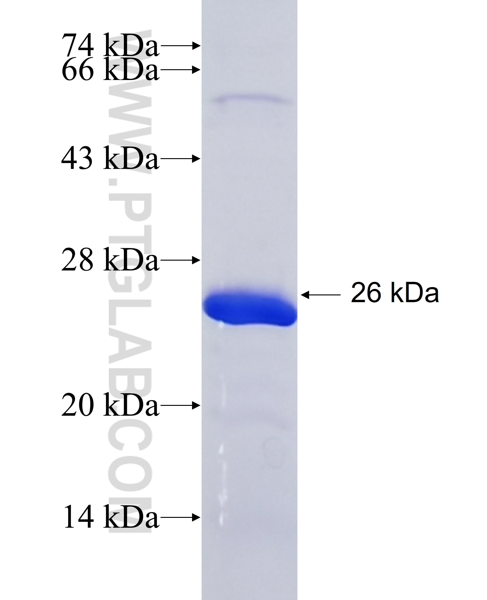 C3AR1 fusion protein Ag28257 SDS-PAGE