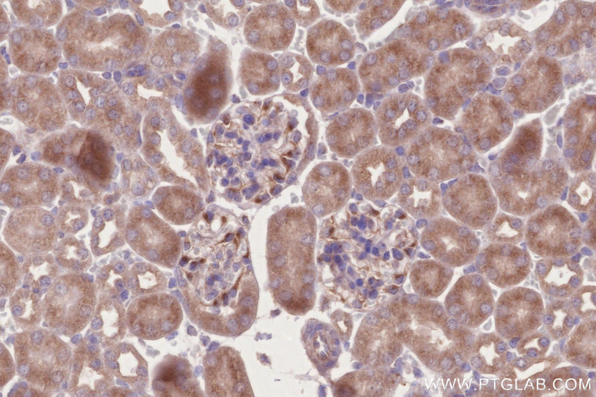 Immunohistochemistry (IHC) staining of mouse kidney tissue using C3orf10 Polyclonal antibody (22157-1-AP)