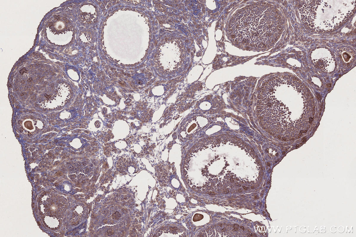 Immunohistochemistry (IHC) staining of mouse ovary tissue using C3orf10 Polyclonal antibody (22157-1-AP)