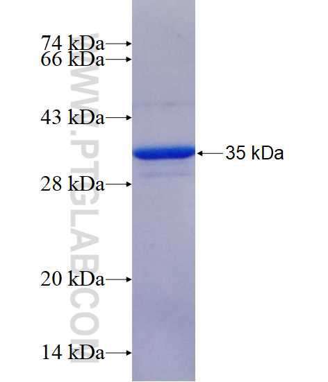 C3orf10 fusion protein Ag17793 SDS-PAGE