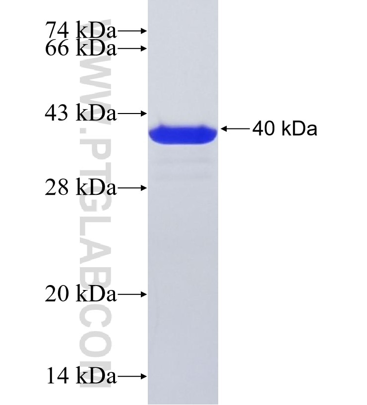 C3orf14 fusion protein Ag29153 SDS-PAGE C3orf14 fusion protein Ag29153 SDS-PAGE