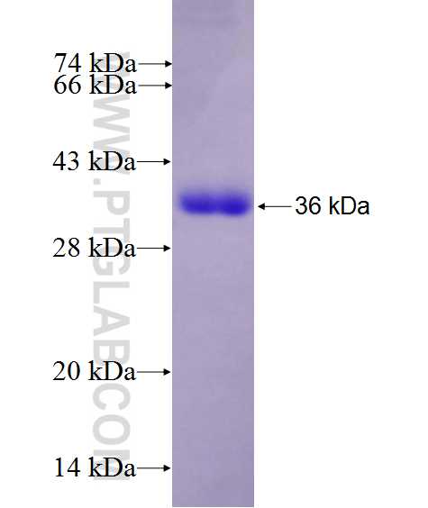 C3orf15 fusion protein Ag27420 SDS-PAGE