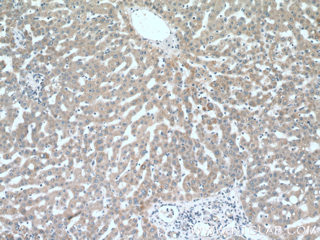 Immunohistochemistry (IHC) staining of human liver tissue using C3orf20 Polyclonal antibody (20906-1-AP)