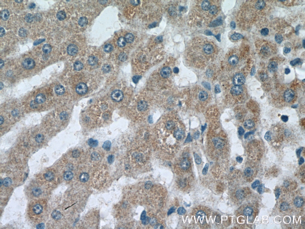 Immunohistochemistry (IHC) staining of human liver tissue using C3orf20 Polyclonal antibody (20906-1-AP)