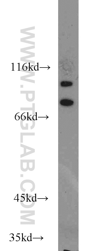 Western Blot (WB) analysis of human brain tissue using C3orf20 Polyclonal antibody (20906-1-AP)