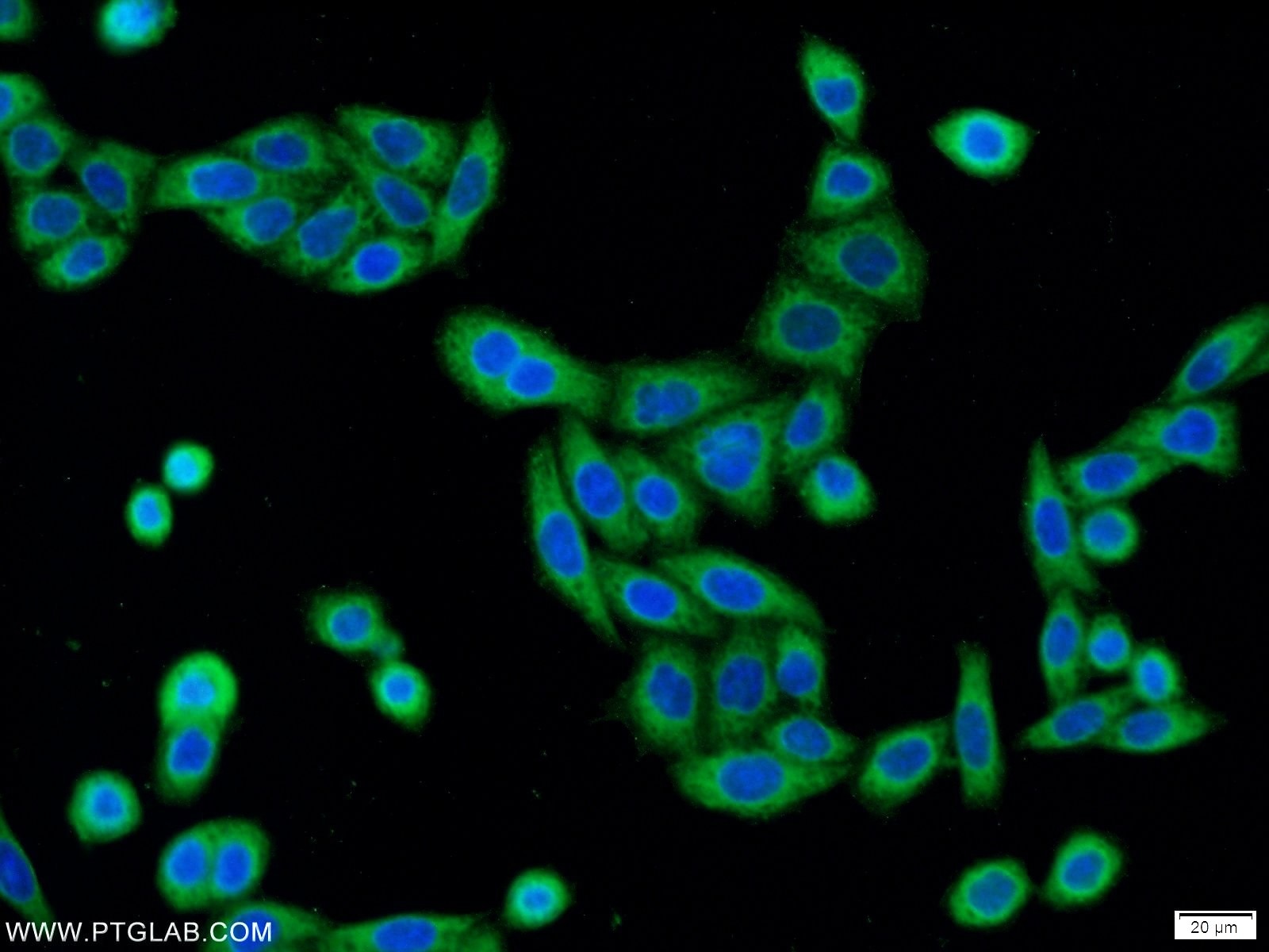 Immunofluorescence (IF) / fluorescent staining of HeLa cells using C3orf21 Polyclonal antibody (20913-1-AP)