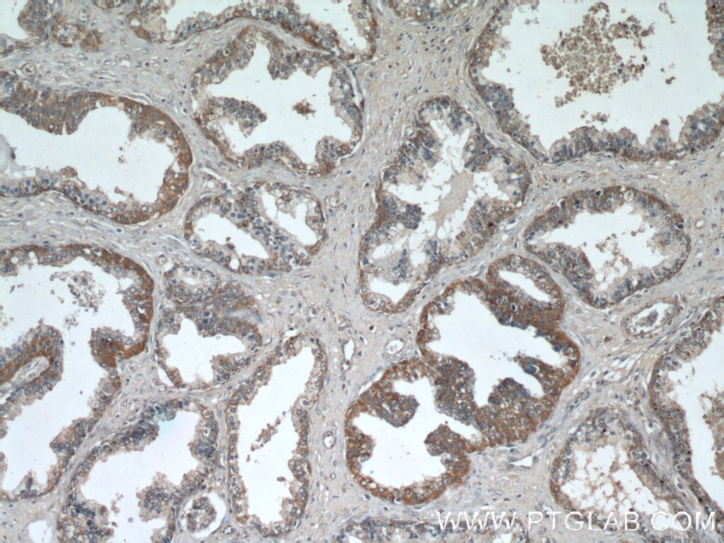 Immunohistochemistry (IHC) staining of human prostate hyperplasia tissue using C3orf21 Polyclonal antibody (20913-1-AP)
