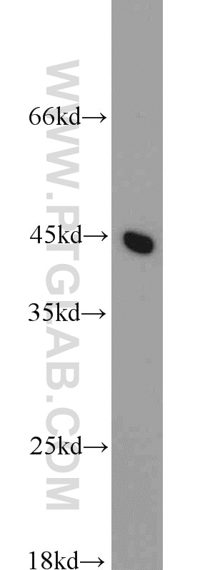 Western Blot (WB) analysis of HeLa cells using C3orf21 Polyclonal antibody (20913-1-AP)