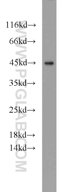 Western Blot (WB) analysis of HeLa cells using C3orf21 Polyclonal antibody (20913-1-AP)