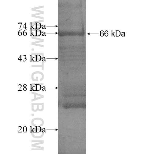 C3orf21 fusion protein Ag15043 SDS-PAGE