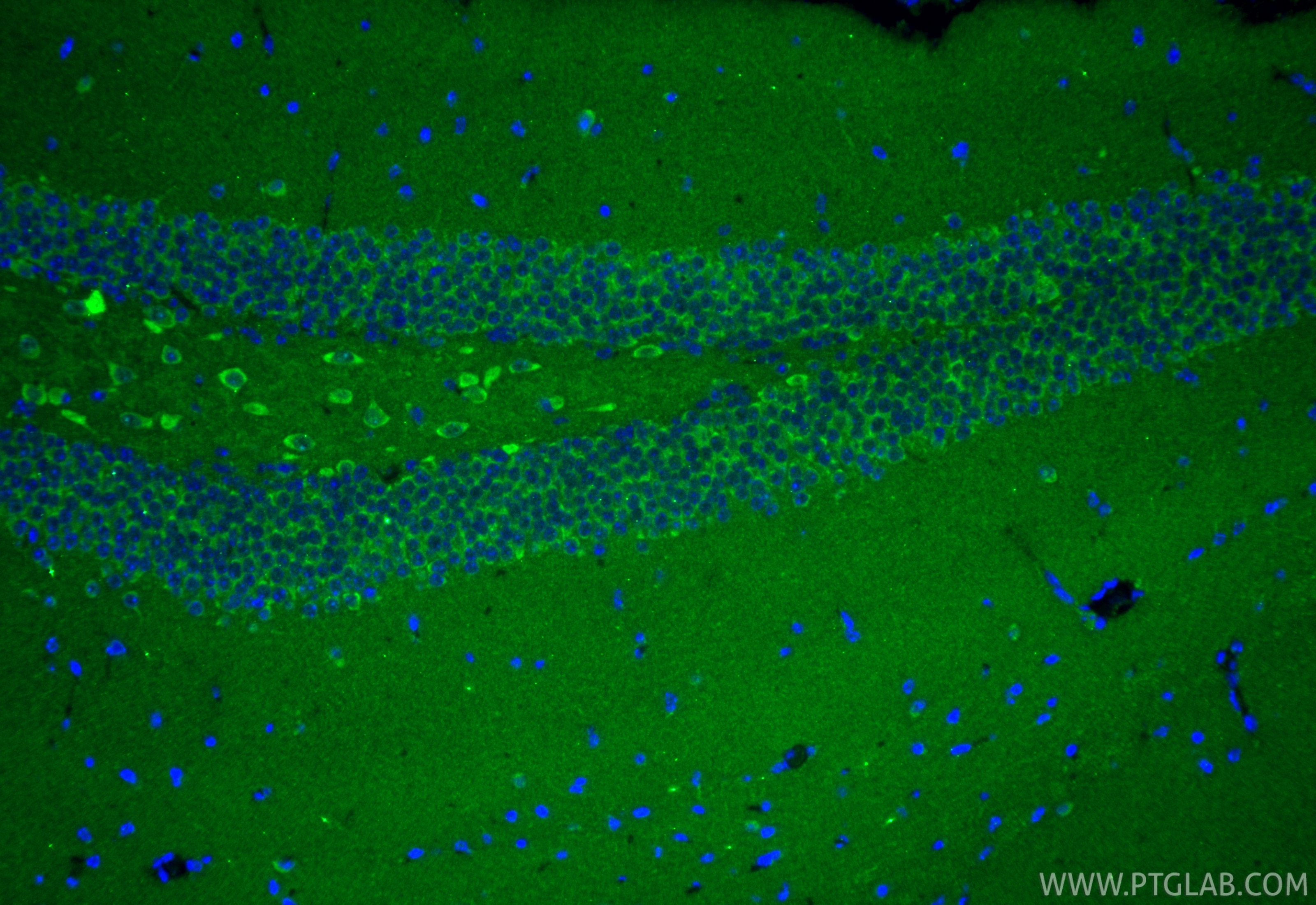 IF Staining of mouse brain using 28137-1-AP Immunofluorescence (IF) / fluorescent staining of mouse brain tissue using C3orf31 Polyclonal antibody (28137-1-AP)