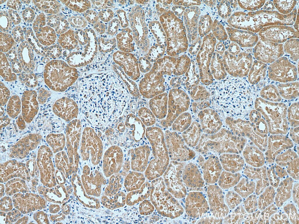 Immunohistochemistry (IHC) staining of human kidney tissue using C3orf31 Polyclonal antibody (28137-1-AP)