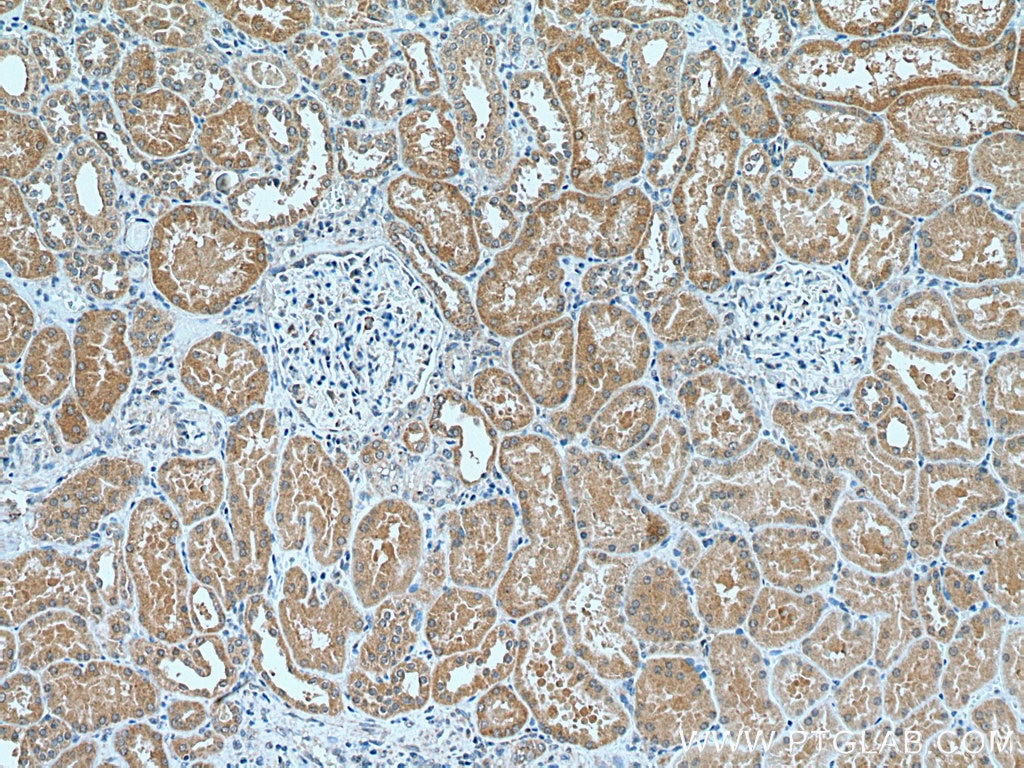 IHC staining of human kidney using 28137-1-AP