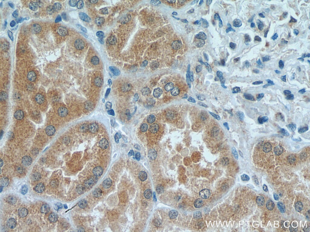 Immunohistochemistry (IHC) staining of human kidney tissue using C3orf31 Polyclonal antibody (28137-1-AP)