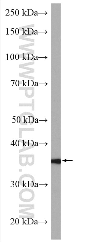 Western Blot (WB) analysis of LNCaP cells using C3orf31 Polyclonal antibody (28137-1-AP)