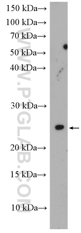 Western Blot (WB) analysis of mouse kidney tissue using CEP19 Polyclonal antibody (26036-1-AP)