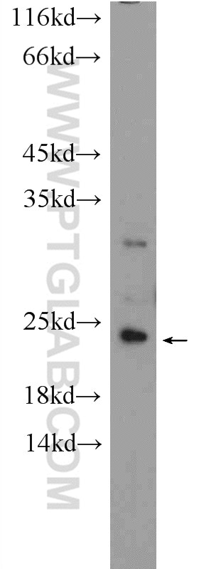 Western Blot (WB) analysis of mouse liver tissue using CEP19 Polyclonal antibody (26036-1-AP)