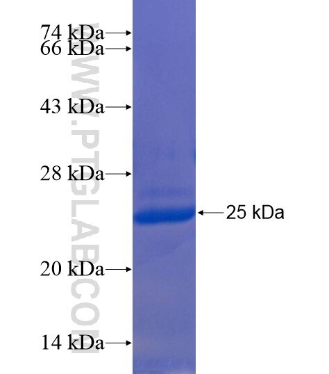 C3orf34 fusion protein Ag22035 SDS-PAGE