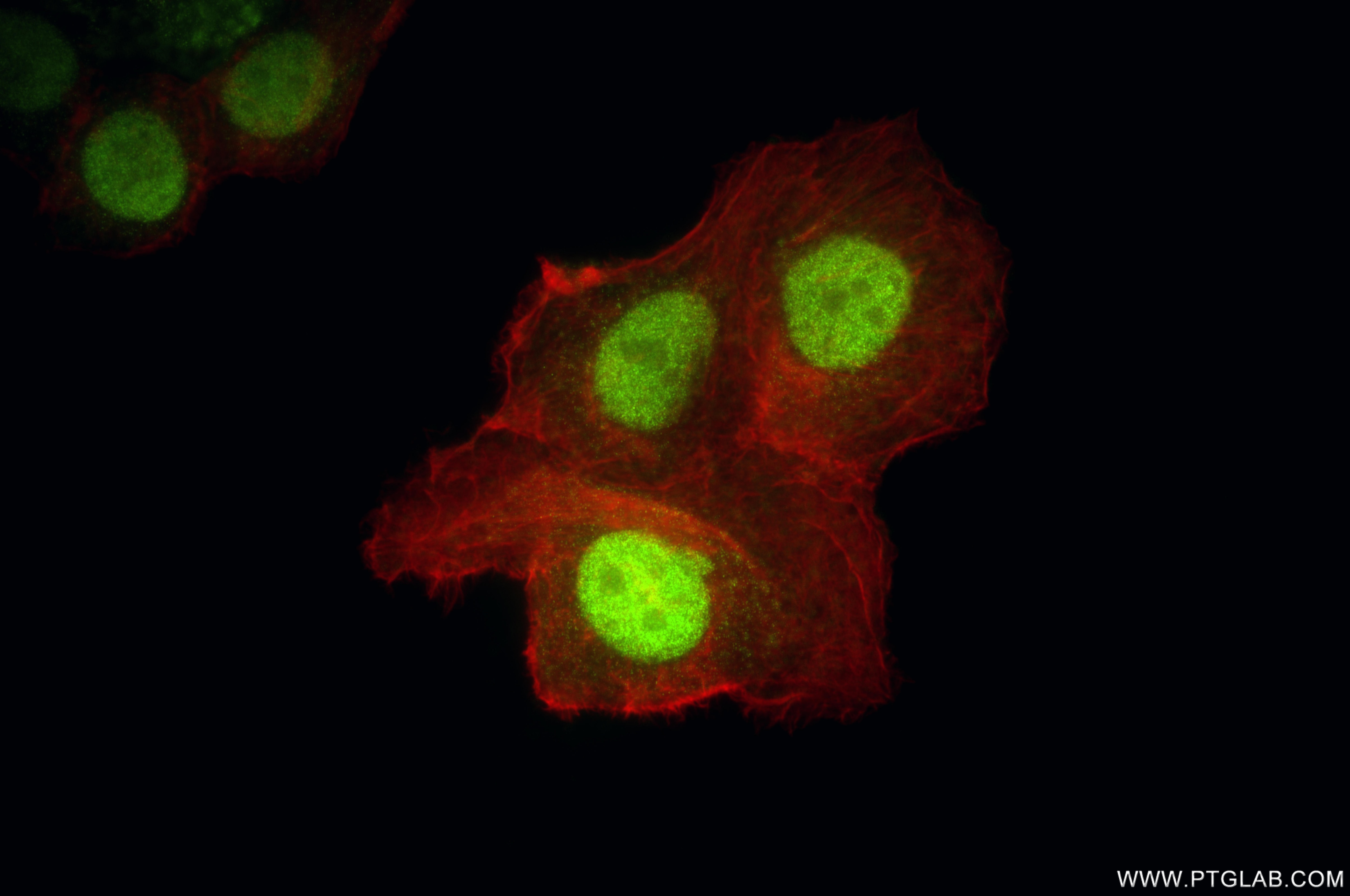 Immunofluorescence (IF) / fluorescent staining of MCF-7 cells using C3orf37 Recombinant monoclonal antibody (84660-4-RR)