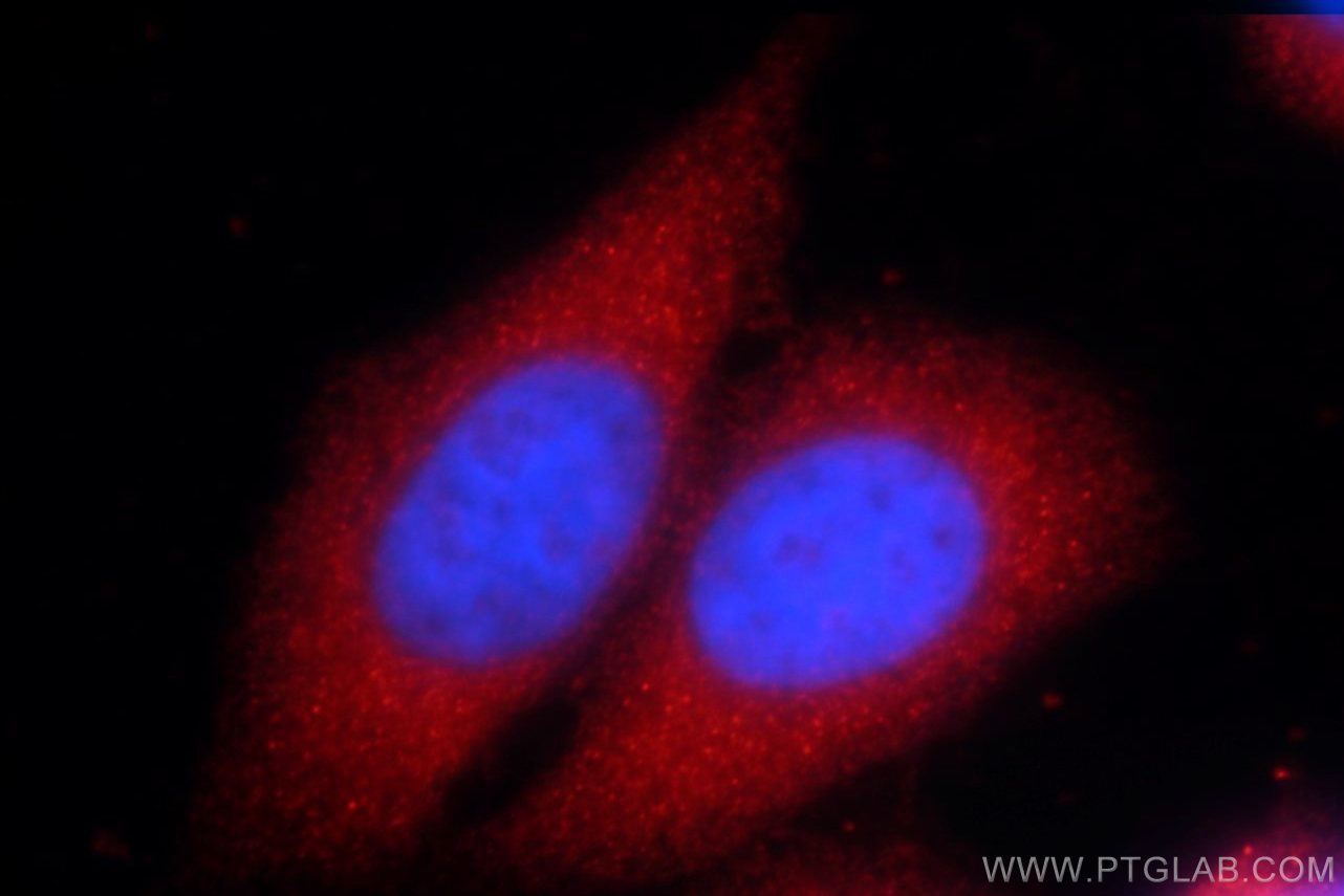 Immunofluorescence (IF) / fluorescent staining of HeLa cells using C3orf43 Polyclonal antibody (25362-1-AP)