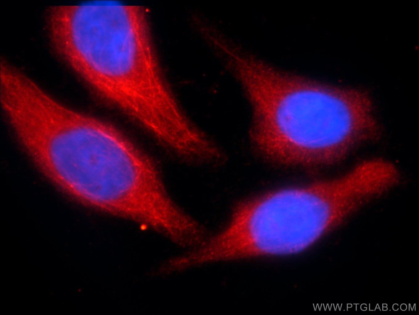 Immunofluorescence (IF) / fluorescent staining of HepG2 cells using C3orf43 Polyclonal antibody (25362-1-AP)