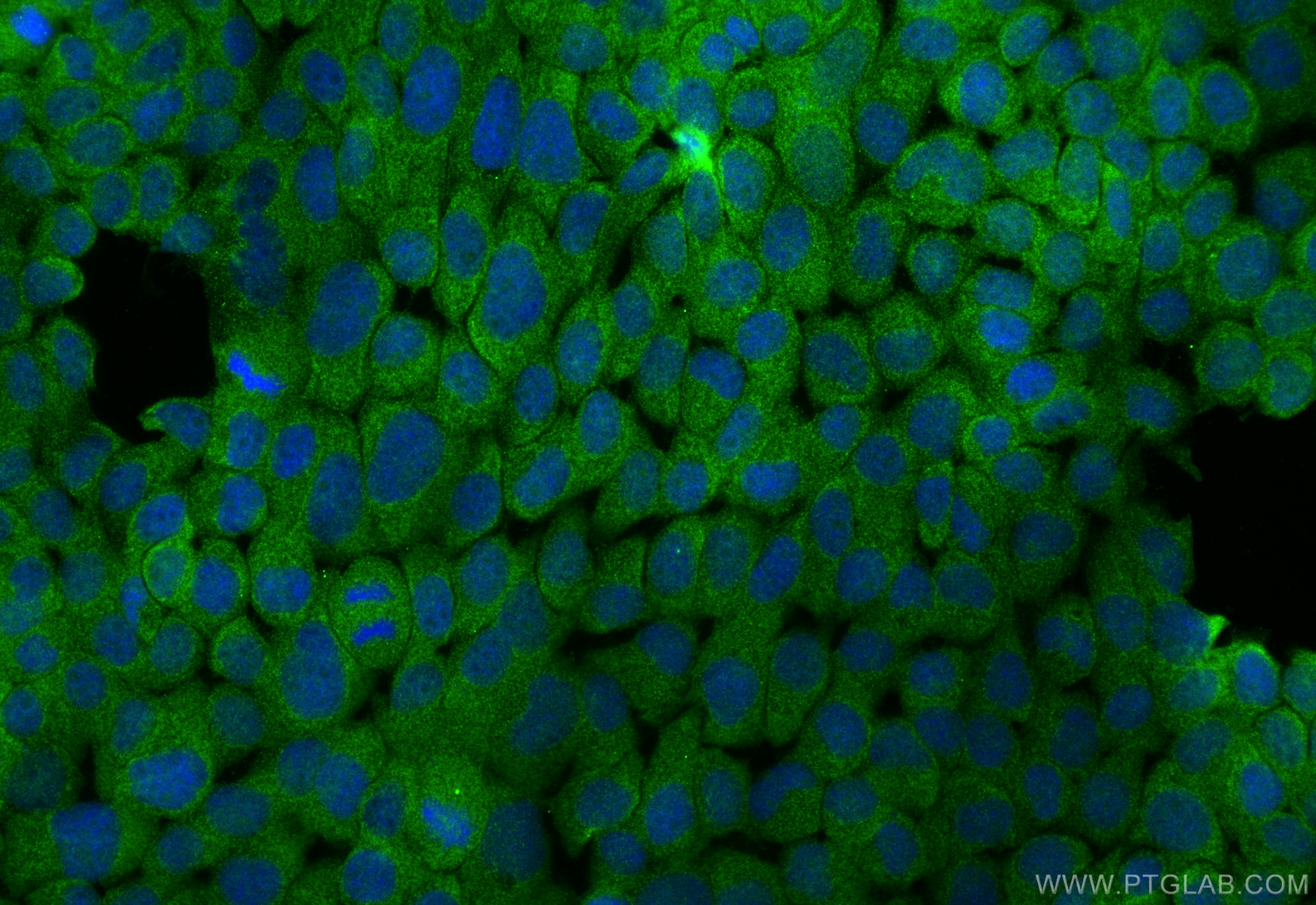 Immunofluorescence (IF) / fluorescent staining of A431 cells using C3orf43 Polyclonal antibody (25362-1-AP)
