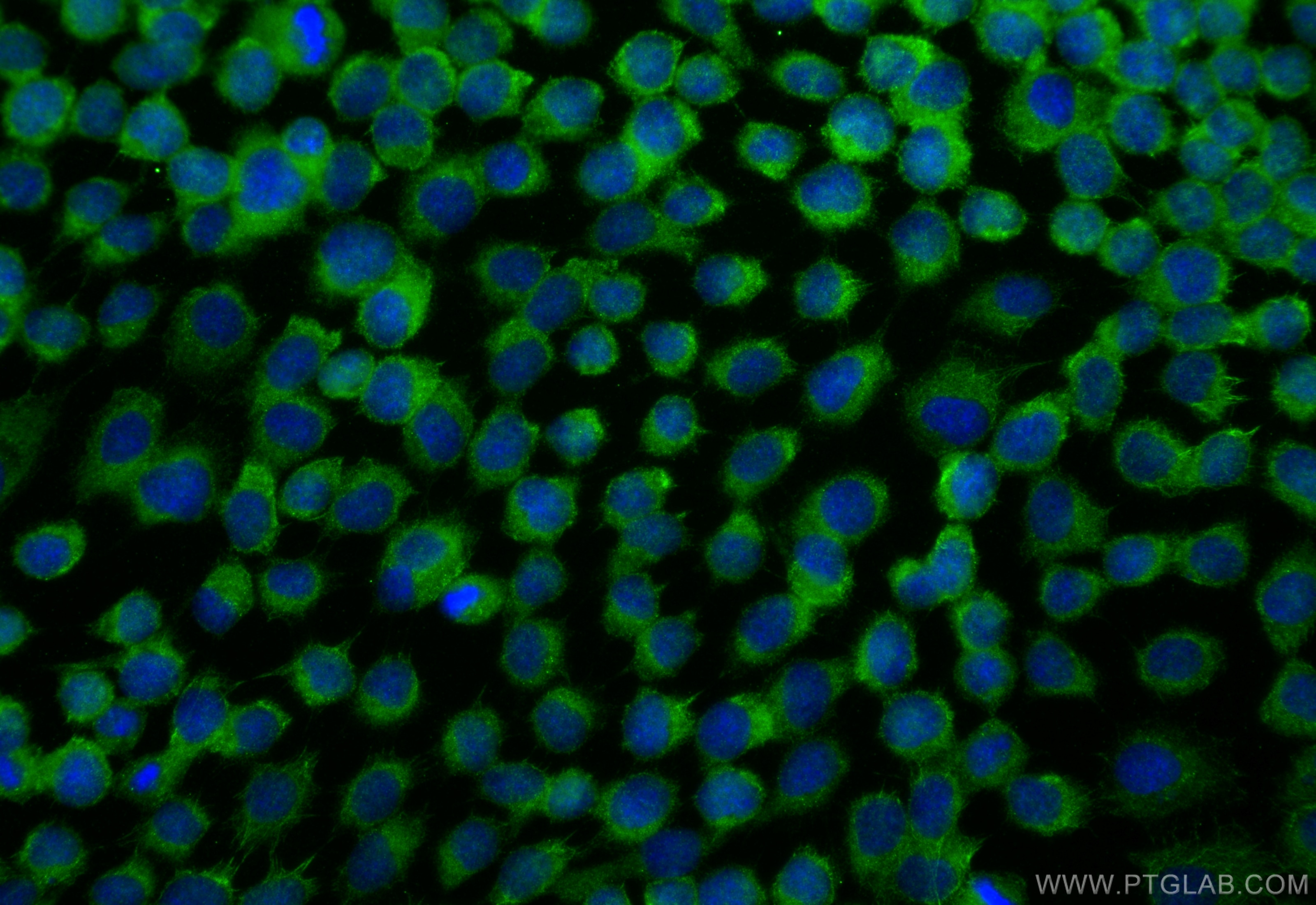 Immunofluorescence (IF) / fluorescent staining of A431 cells using C3orf43 Polyclonal antibody (25362-1-AP)