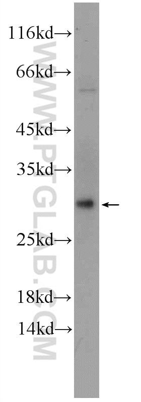 Western Blot (WB) analysis of mouse heart tissue using C3orf43 Polyclonal antibody (25362-1-AP)
