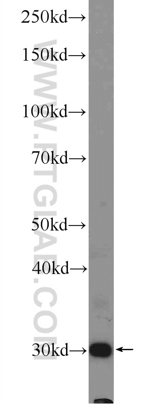 Western Blot (WB) analysis of human plasma using C3orf43 Polyclonal antibody (25362-1-AP)