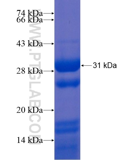 C3orf43 fusion protein Ag21670 SDS-PAGE