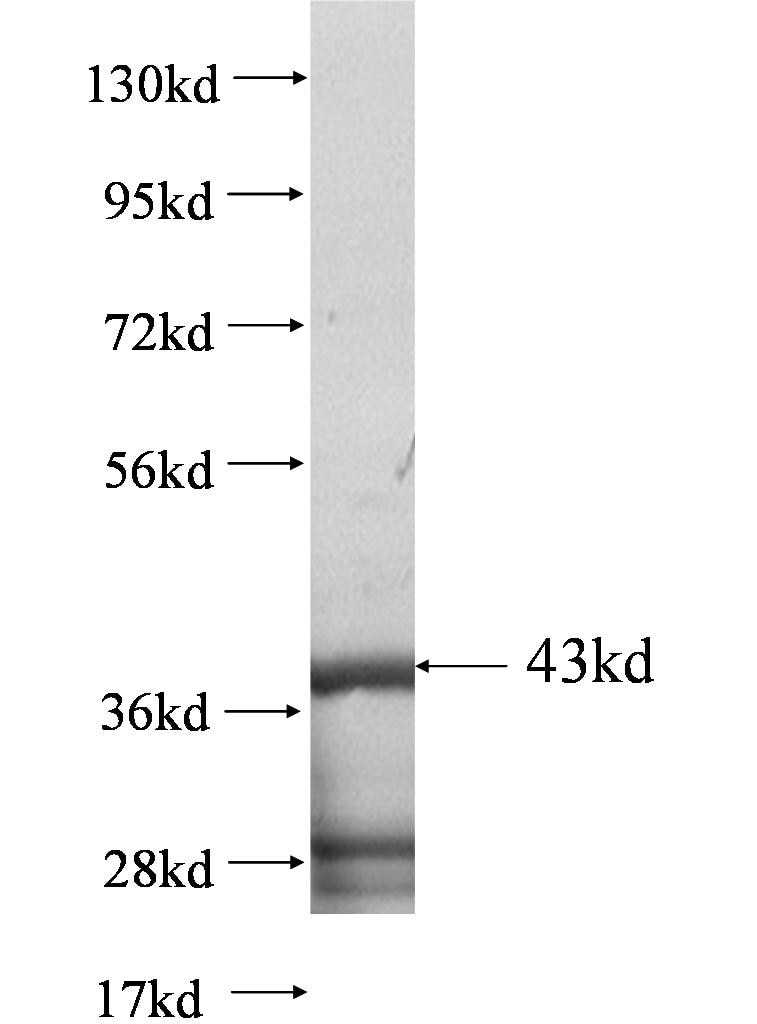 C3orf52 fusion protein Ag0618 SDS-PAGE