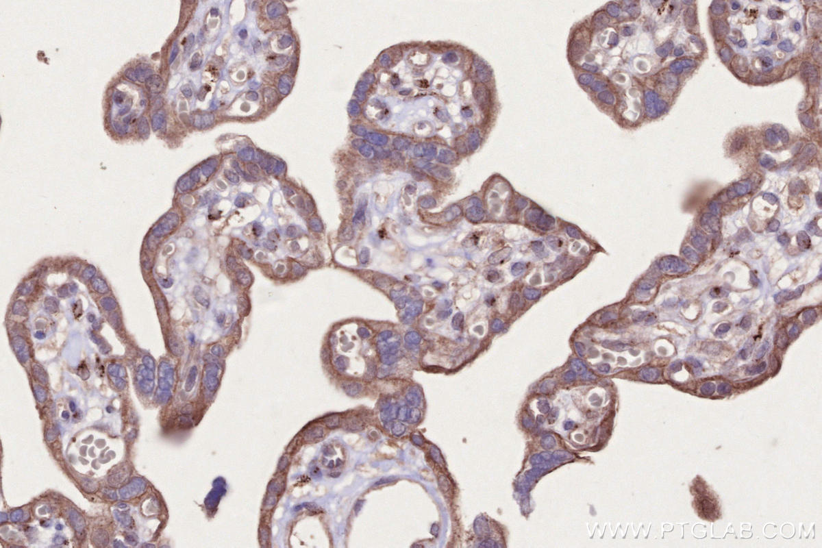 Immunohistochemistry (IHC) staining of human placenta tissue using C3orf58 Polyclonal antibody (27145-1-AP)