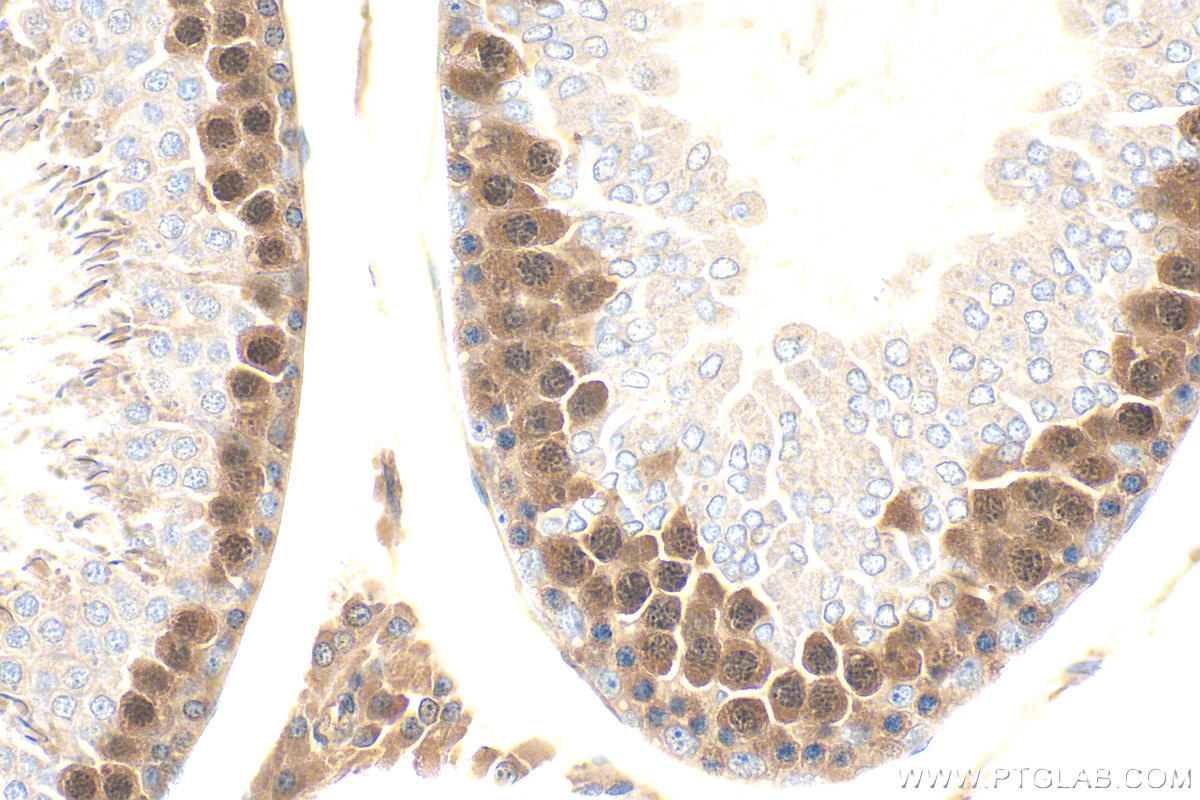 IHC staining of rat testis using 32718-1-AP (same clone as 32718-1-PBS) Immunohistochemistry (IHC) staining of rat testis tissue using C3orf62 Polyclonal antibody (32718-1-AP)