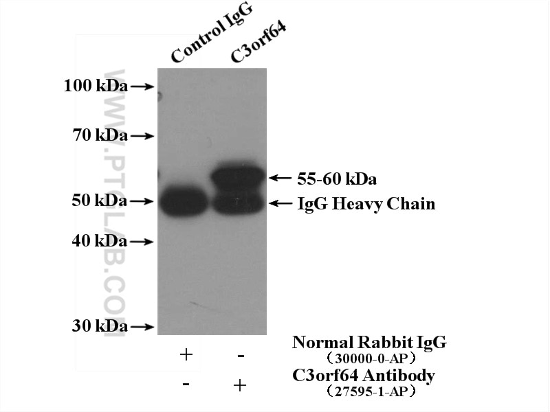 Immunoprecipitation (IP) experiment of mouse brain tissue using C3orf64 Polyclonal antibody (27595-1-AP)