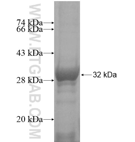 C3orf75 fusion protein Ag14490 SDS-PAGE