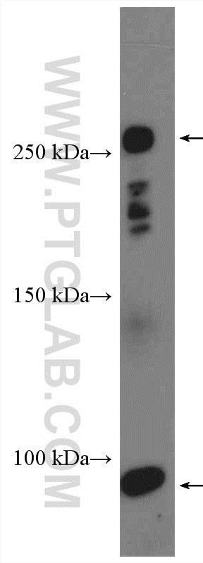 Western Blot (WB) analysis of human blood using C4-B Alpha Chain/C4b-B/C4d-B Polyclonal antibody (55228-1-AP)