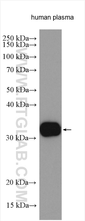 WB analysis of human plasma using 17160-1-AP