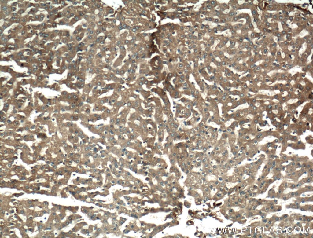 Immunohistochemistry (IHC) staining of human liver tissue using C4 Alpha Chain/C4b/C4d Polyclonal antibody (22233-1-AP)
