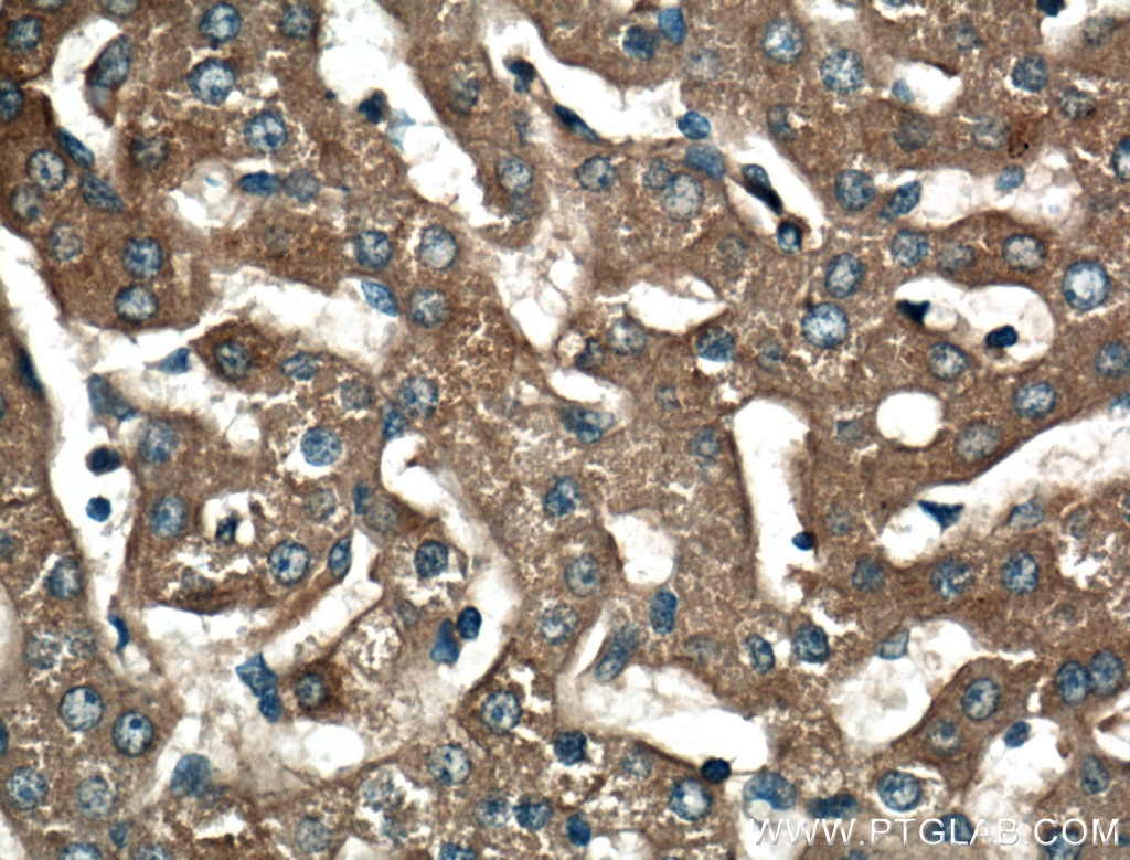Immunohistochemistry (IHC) staining of human liver tissue using C4 Alpha Chain/C4b/C4d Polyclonal antibody (22233-1-AP)