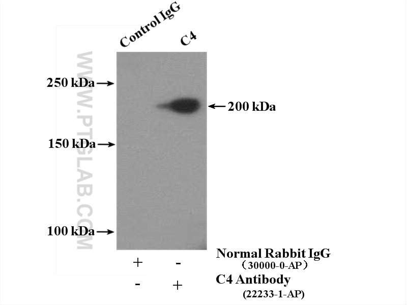 Immunoprecipitation (IP) experiment of L02 cells using C4 Alpha Chain/C4b/C4d Polyclonal antibody (22233-1-AP)