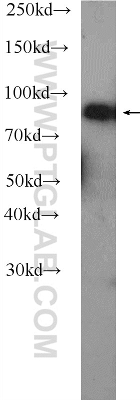 Western Blot (WB) analysis of human blood using C4 Alpha Chain/C4b/C4d Polyclonal antibody (22233-1-AP)